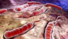 پیشگیری از ابتلا به بیماری وبا